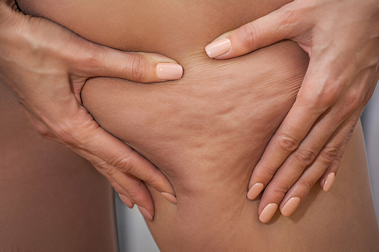 Red Light Therapy for Cellulite