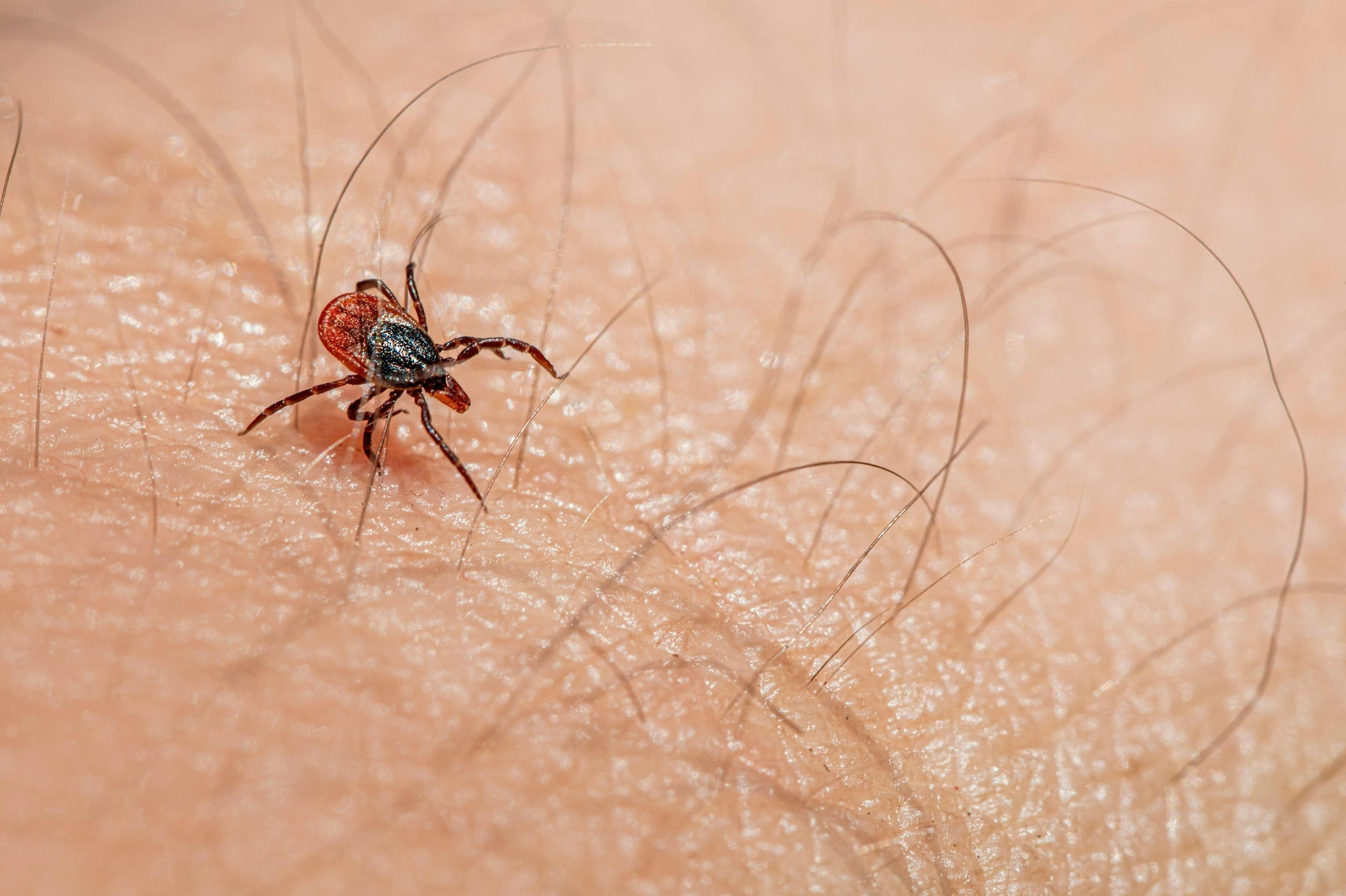red light therapy for lyme disease